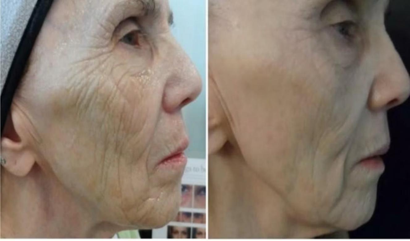 74-year-old female — combined protocol — clinical case imagery