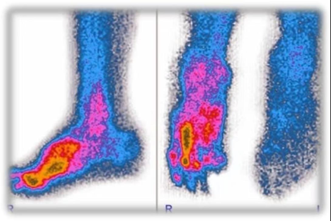 Neuropathy pilot — 6 patients, 30 days — clinical case imagery
